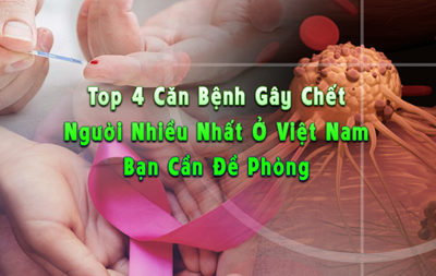 Top 4 Căn Bệnh Gây Chết Người Nhiều Nhất Ở Việt Nam Bạn Cần Đề Phòng